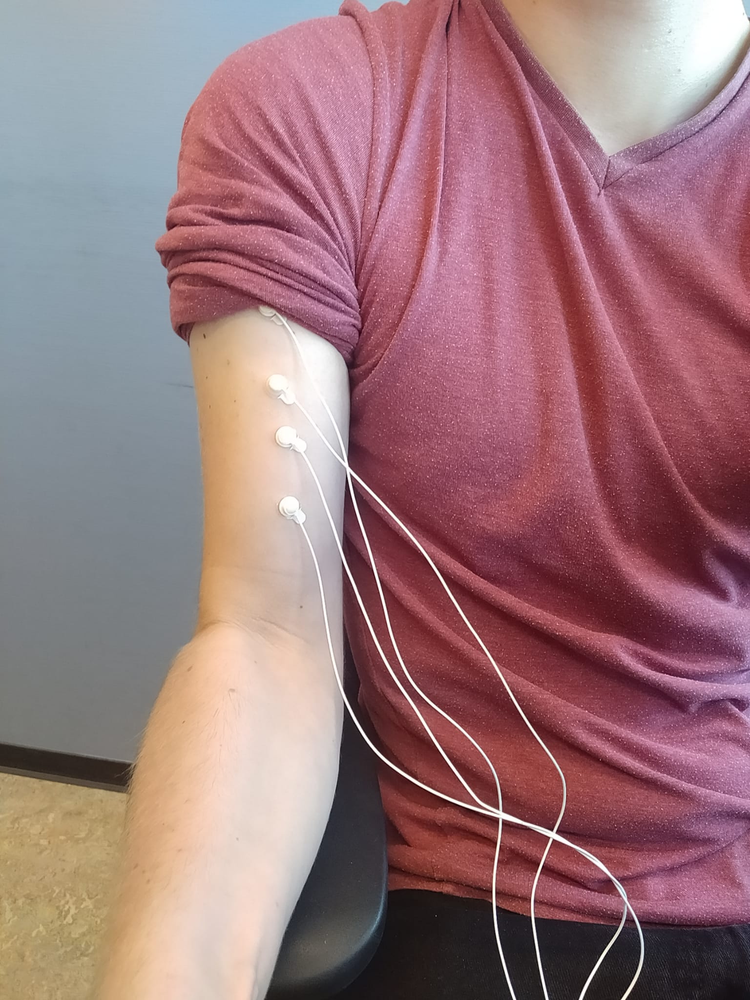 Figure 1: Placement of the 4 electrodes on the upper arm to measure the impedance of the bicep brachii.